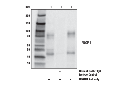 Immunoprecipitation Image 1: IFNGR1 Antibody