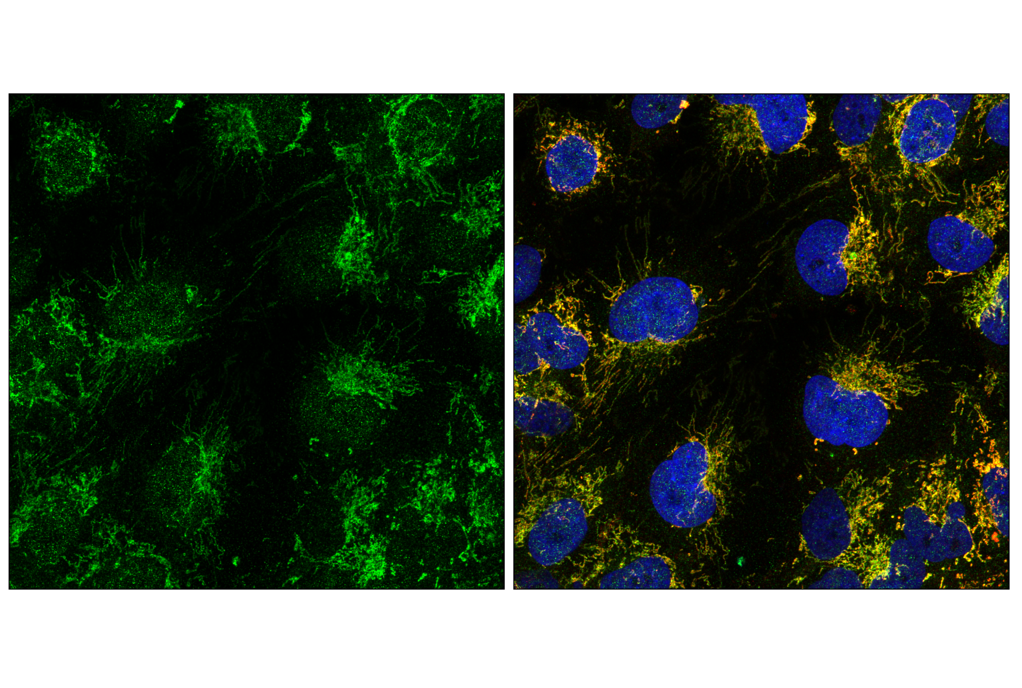 Immunofluorescence Image 1: TIM23 (E1Q7L) Rabbit mAb