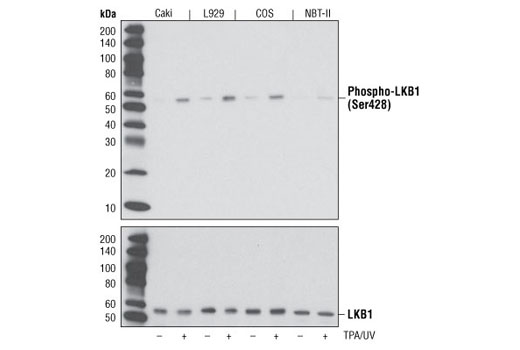  Image 2: PhosphoPlus® LKB1 (Ser428) Antibody Duet