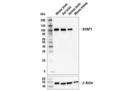 Western Blotting Image 1: NYAP1 Antibody