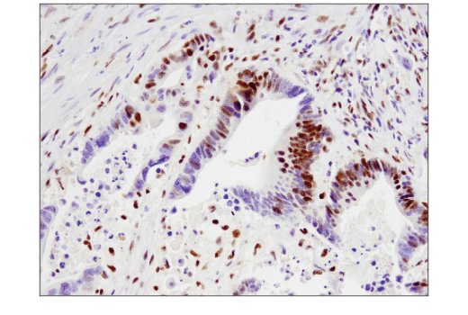 Immunohistochemistry Image 1: SLFN11 (D8W1B) Rabbit mAb (BSA and Azide Free)