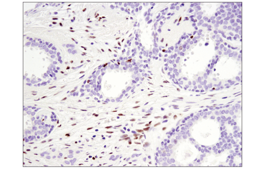 Immunohistochemistry Image 2: SLFN11 (D8W1B) Rabbit mAb (BSA and Azide Free)