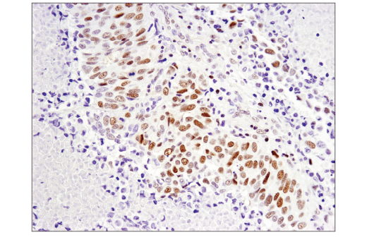 Immunohistochemistry Image 3: SLFN11 (D8W1B) Rabbit mAb (BSA and Azide Free)