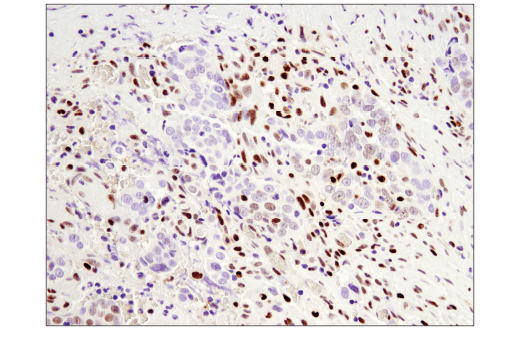 Immunohistochemistry Image 5: SLFN11 (D8W1B) Rabbit mAb (BSA and Azide Free)