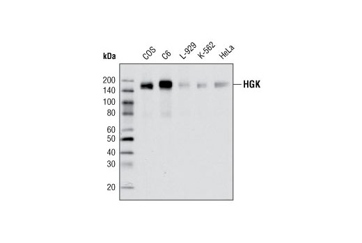 Western Blotting Image 1: HGK Antibody