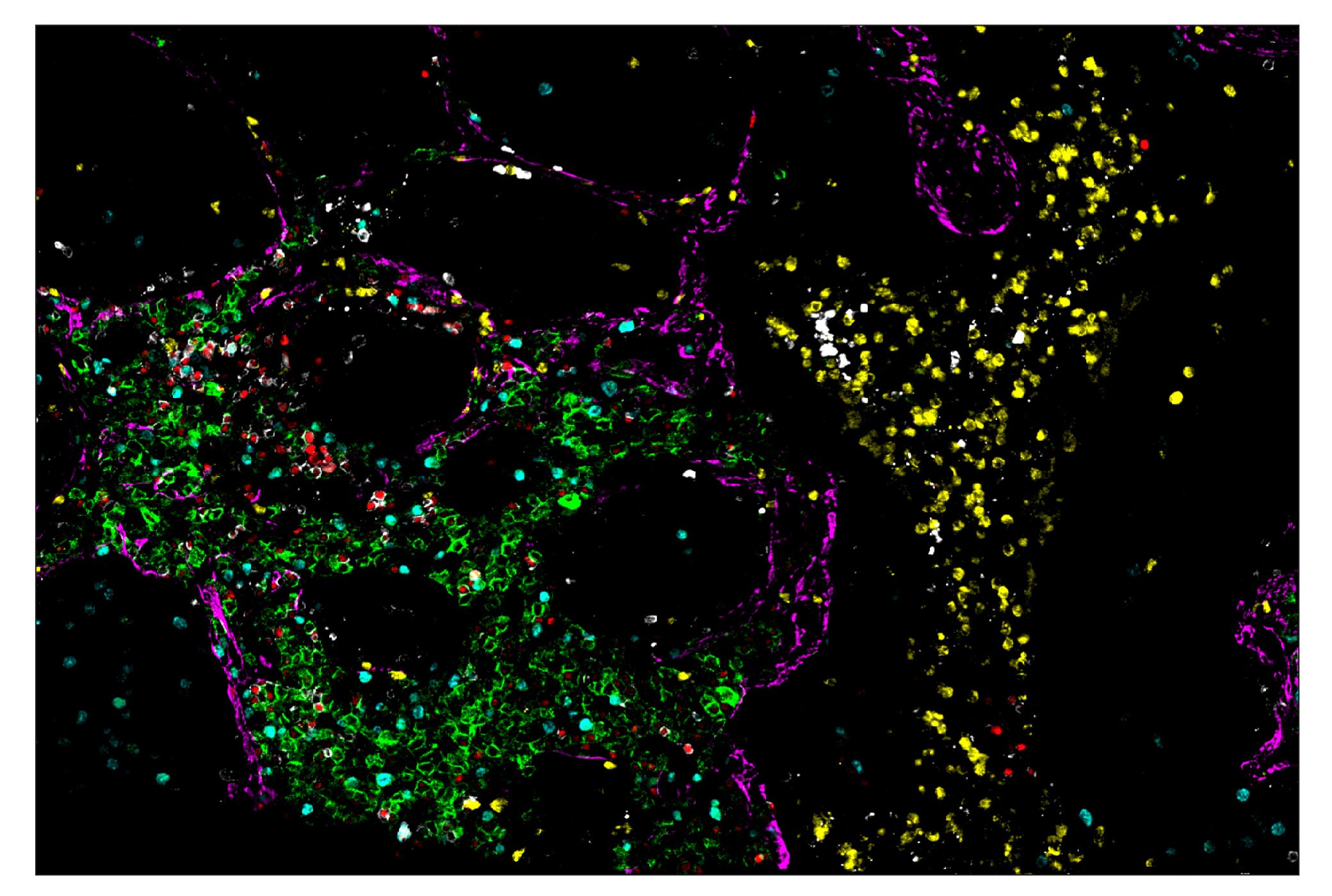Immunohistochemistry Image 7: CD19 (Intracellular Domain) (D4V4B) & CO-0054-647 SignalStar™ Oligo-Antibody Pair