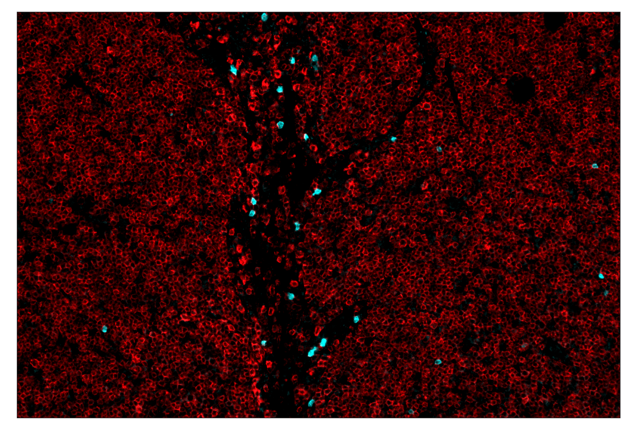 Immunohistochemistry Image 8: CD19 (Intracellular Domain) (D4V4B) & CO-0054-488 SignalStar™ Oligo-Antibody Pair