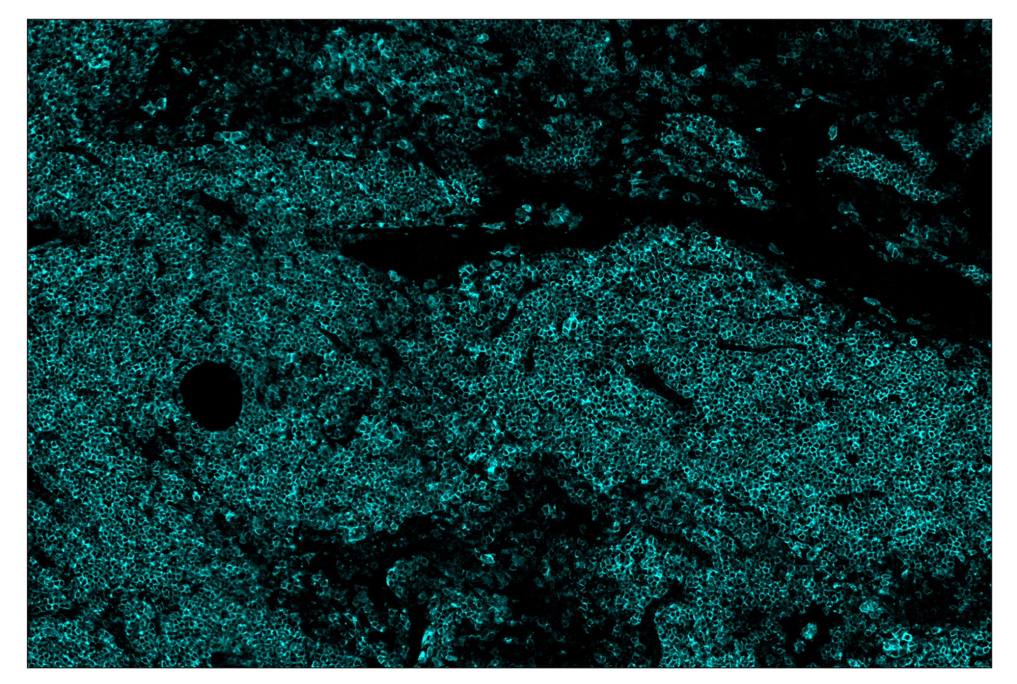 Immunohistochemistry Image 4: CD19 (Intracellular Domain) (D4V4B) & CO-0054-488 SignalStar™ Oligo-Antibody Pair