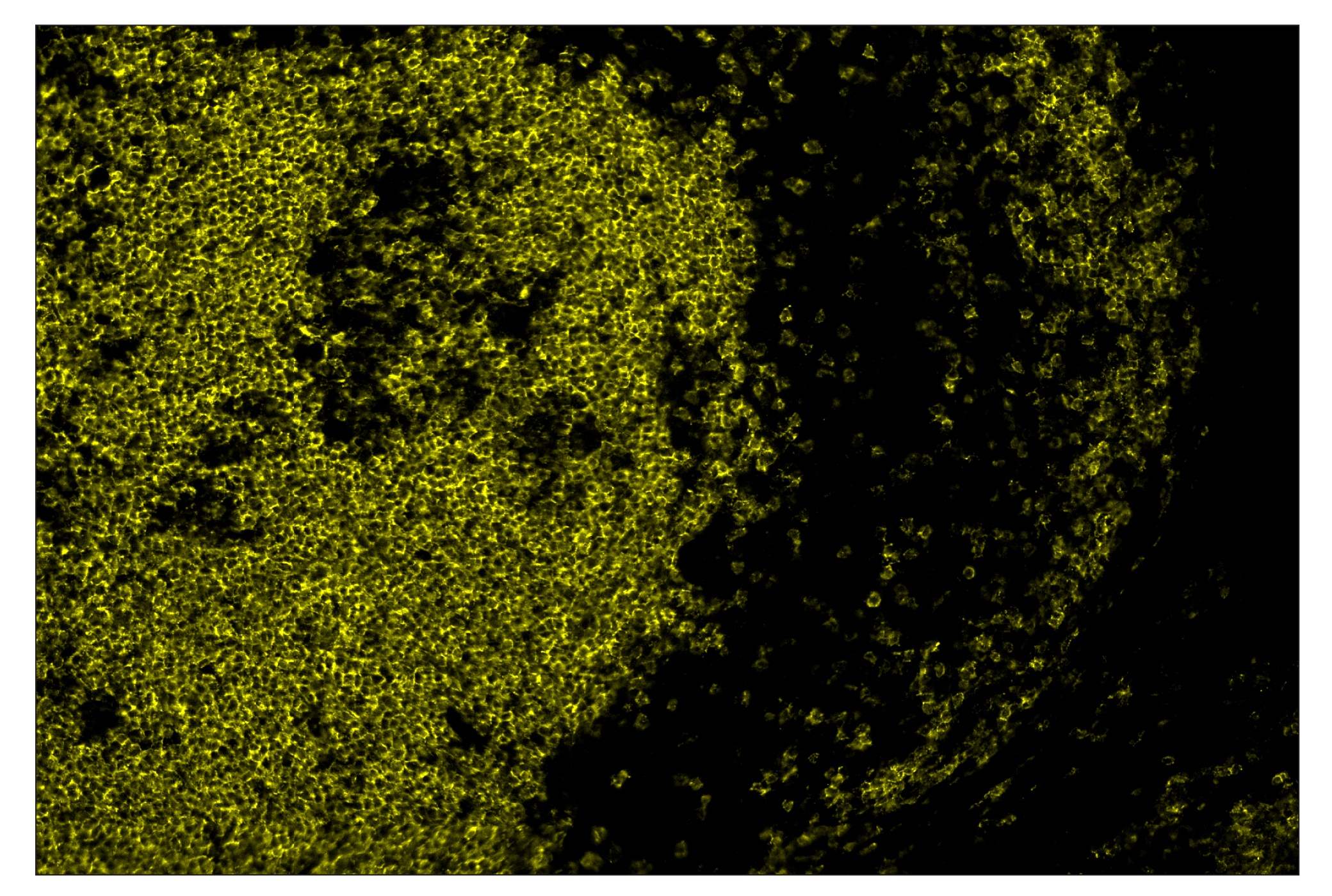 Immunohistochemistry Image 2: CD19 (Intracellular Domain) (D4V4B) & CO-0054-594 SignalStar™ Oligo-Antibody Pair