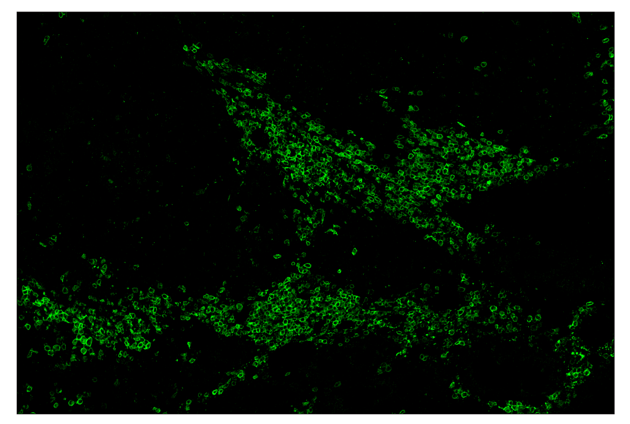 Immunohistochemistry Image 1: CD19 (Intracellular Domain) (D4V4B) & CO-0054-750 SignalStar™ Oligo-Antibody Pair