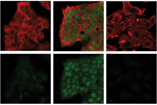 Immunofluorescence Image 1: Phospho-Stat3 (Ser727) (D4X3C) Rabbit mAb