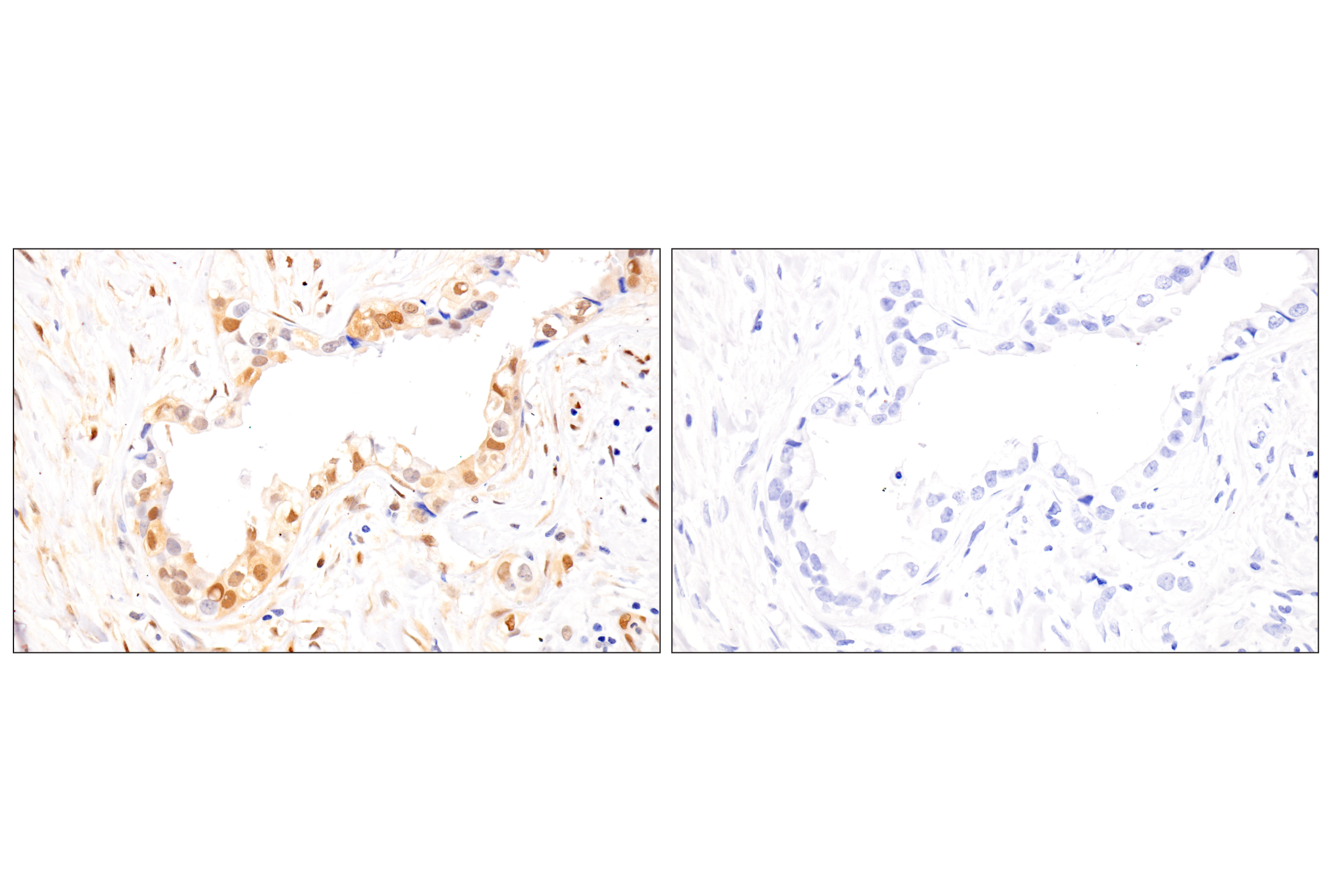 Immunohistochemistry Image 12: Phospho-Stat3 (Ser727) (D4X3C) Rabbit Monoclonal Antibody