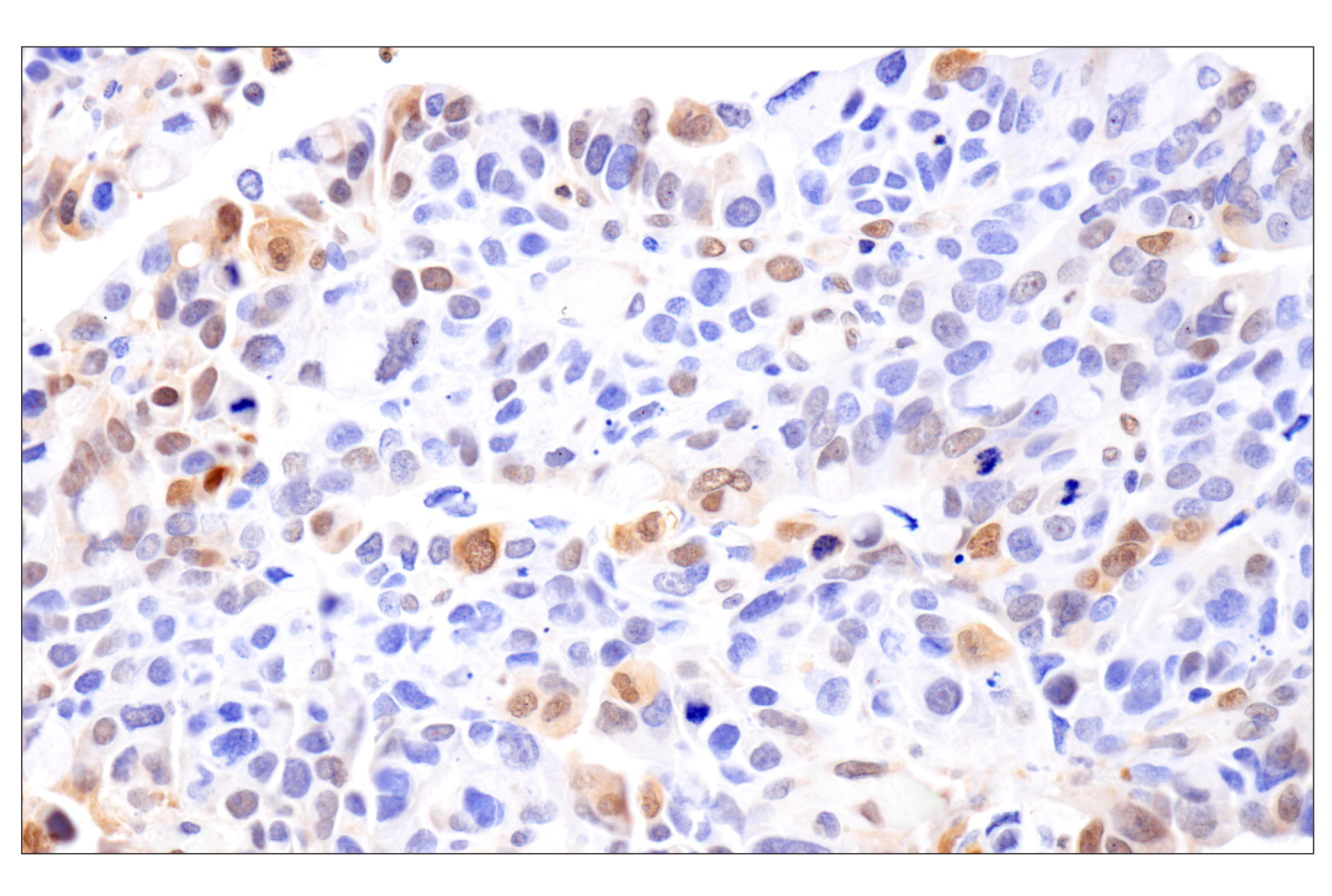 Immunohistochemistry Image 5: Phospho-Stat3 (Ser727) (D4X3C) Rabbit Monoclonal Antibody