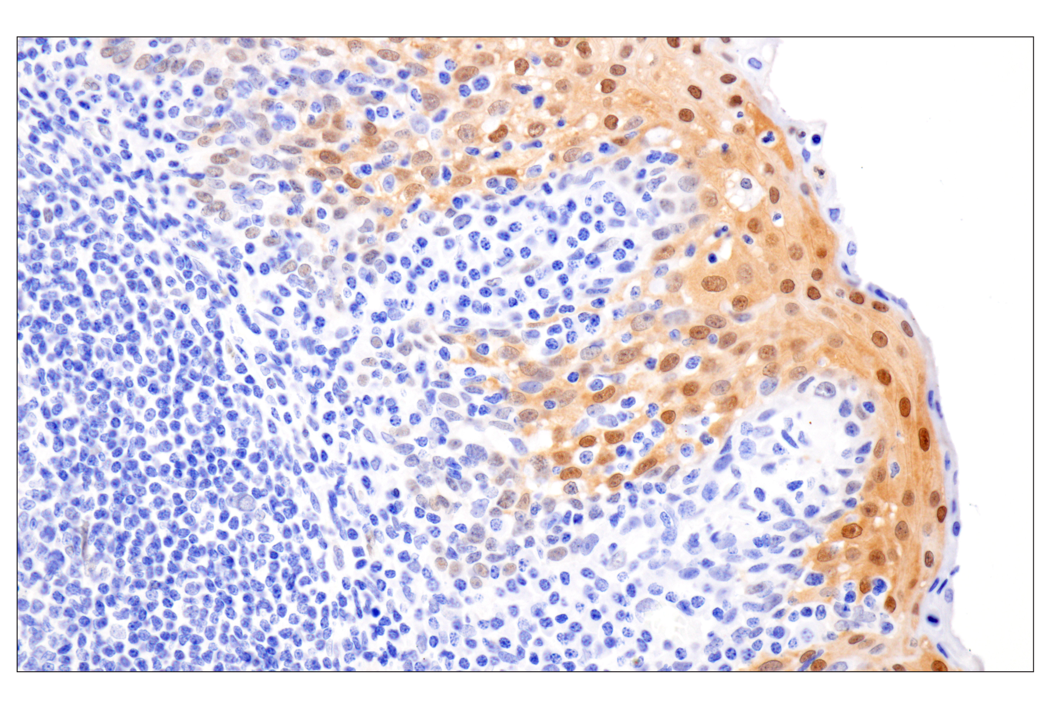 Immunohistochemistry Image 6: Phospho-Stat3 (Ser727) (D4X3C) Rabbit Monoclonal Antibody
