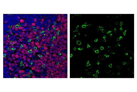 Immunofluorescence Image 1: PD-1 (Intracellular Domain) (D7D5W) XP® Rabbit mAb (Alexa Fluor® 488 Conjugate)