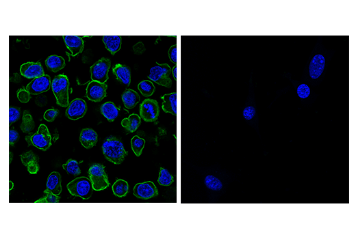 Immunofluorescence Image 2: PD-1 (Intracellular Domain) (D7D5W) XP® Rabbit mAb (Alexa Fluor® 488 Conjugate)