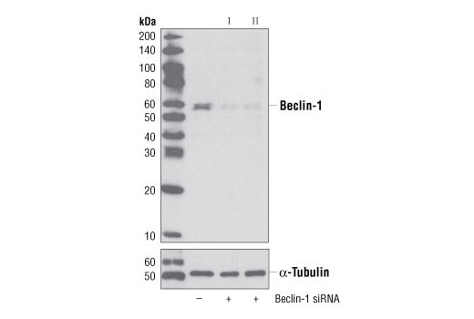  Image 13: AMPK Substrate Antibody Sampler Kit