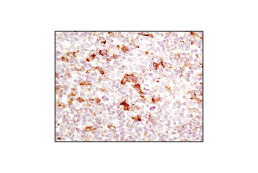 Immunohistochemistry Image 2: PDI (C81H6) Rabbit mAb