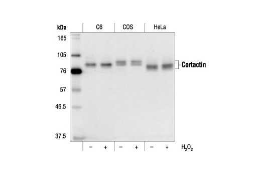 Western Blotting Image 1: Cortactin Antibody