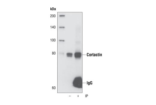 Immunoprecipitation Image 1: Cortactin (H222) Antibody
