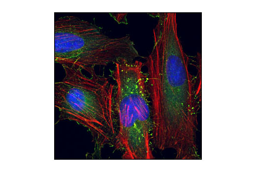 Immunofluorescence Image 1: Cortactin (H222) Antibody