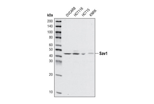 Western Blotting Image 1: Sav1 Antibody