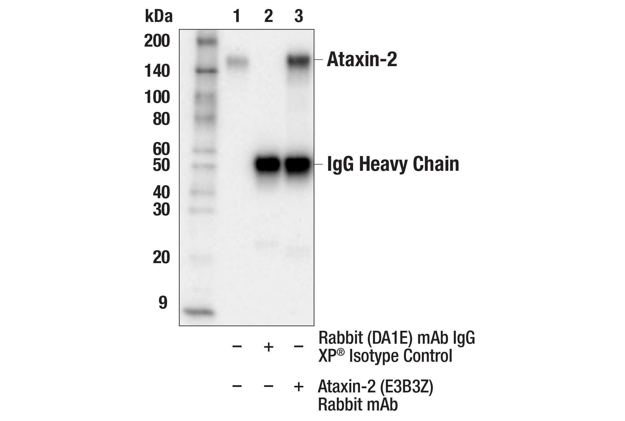 Immunoprecipitation Image 1: Ataxin-2 (E3B3Z) Rabbit mAb