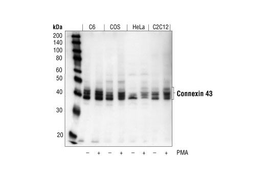 Western Blotting Image 1: Connexin 43 Antibody