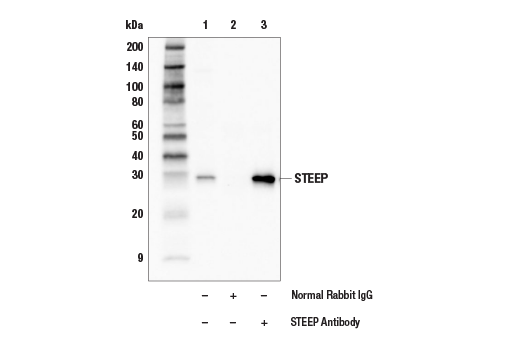 Immunoprecipitation Image 1: STEEP Antibody