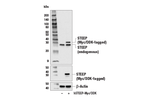 Western Blotting Image 3: STEEP Antibody