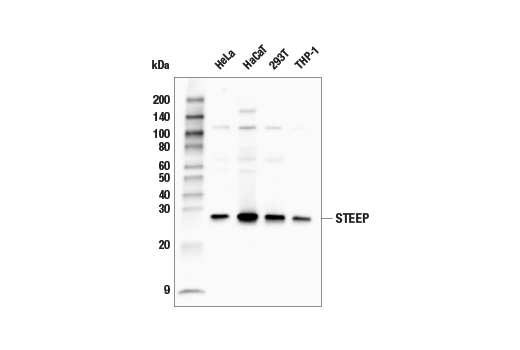 Western Blotting Image 1: STEEP Antibody
