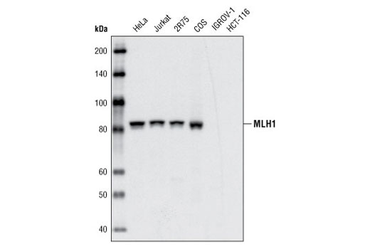Western Blotting Image 1: MLH1 (4C9C7) Mouse mAb