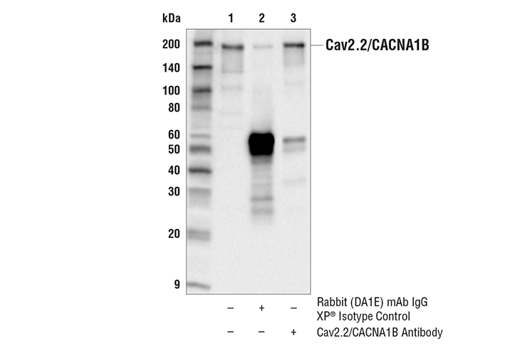 Immunoprecipitation Image 1: Cav2.2/CACNA1B Antibody