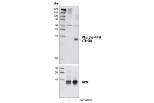 Western Blotting Image 1: Phospho-NPM (Thr95) Antibody