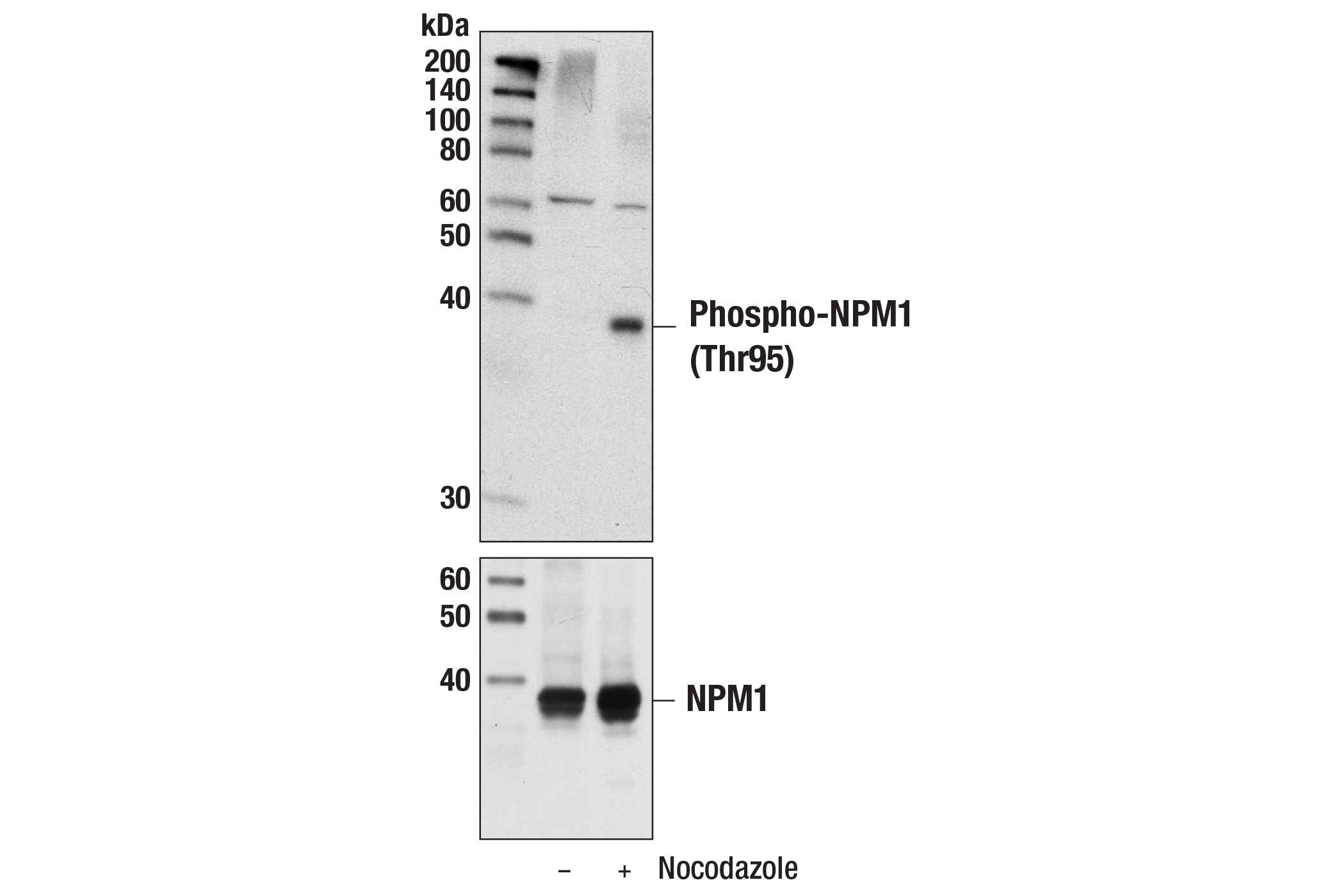 Western Blotting Image 1: Phospho-NPM1 (Thr95) Antibody