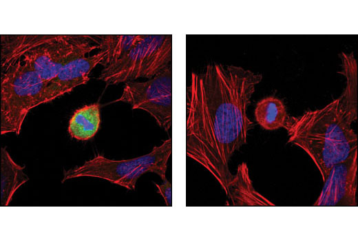 Immunofluorescence Image 1: Phospho-NPM (Thr95) Antibody