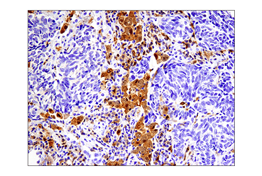 Immunohistochemistry Image 4: IRF-5 (E7F9W) Rabbit mAb (BSA and Azide Free)