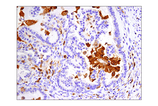 Immunohistochemistry Image 5: IRF-5 (E7F9W) Rabbit mAb (BSA and Azide Free)