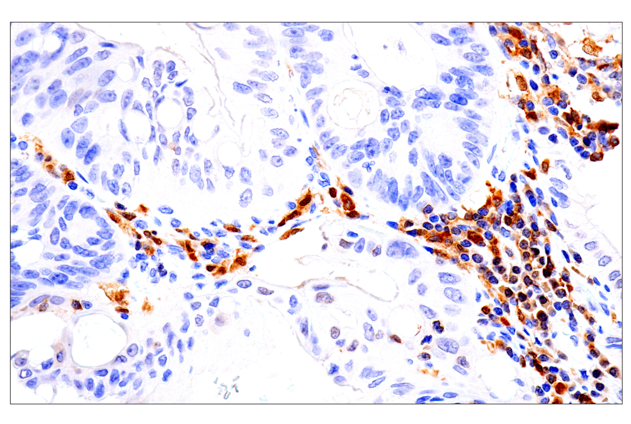 Immunohistochemistry Image 3: IRF-5 (E7F9W) Rabbit mAb (BSA and Azide Free)