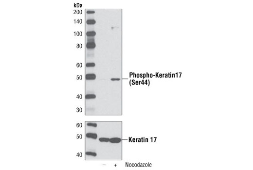 Western Blotting Image 1: Phospho-Keratin 17 (Ser44) Antibody