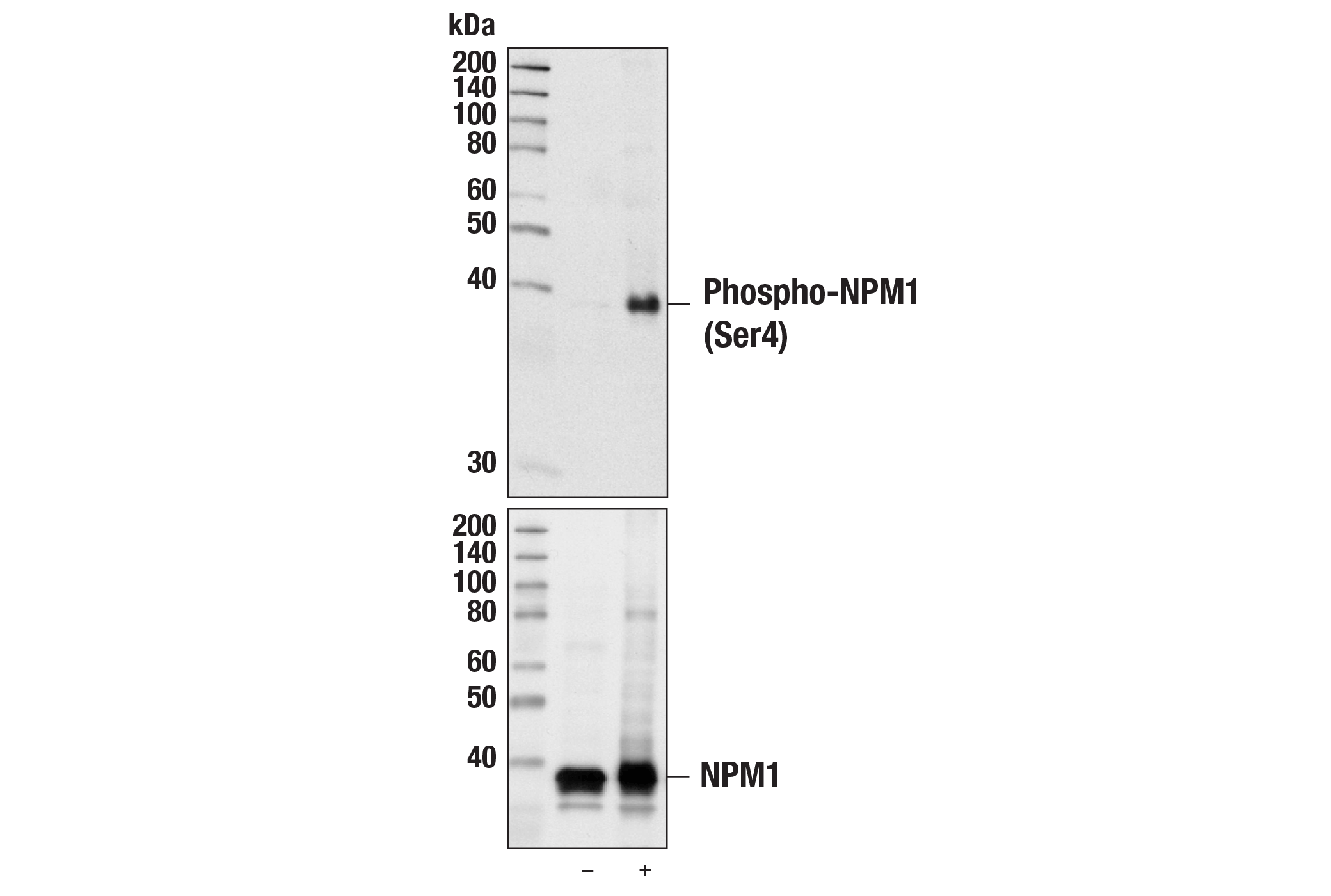 Western Blotting Image 1: Phospho-NPM1 (Ser4) (D19C1) XP® Rabbit mAb