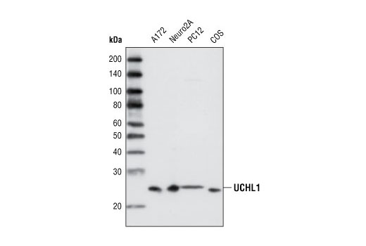 Western Blotting Image 1: UCHL1 Antibody
