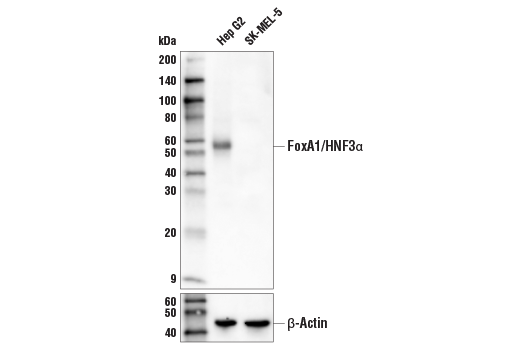 Western Blotting Image 1: FoxA1/HNF3α (E7E8W) Rabbit mAb (Biotinylated)