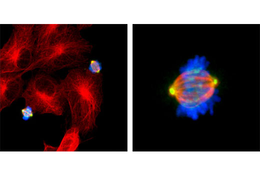 Immunofluorescence Image 1: Phospho-Aurora A (Thr288)/Aurora B (Thr232)/Aurora C (Thr198) (D13A11) Rabbit Monoclonal Antibody (BSA and Azide Free)