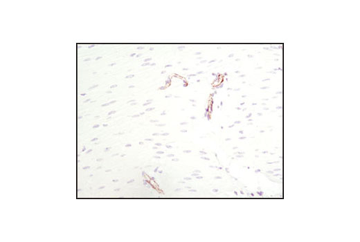 Immunohistochemistry Image 1: CD31 (PECAM-1) (89C2) Mouse mAb