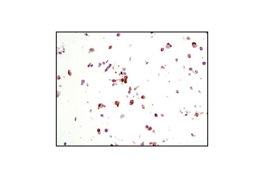 Immunohistochemistry Image 2: CD31 (PECAM-1) (89C2) Mouse mAb