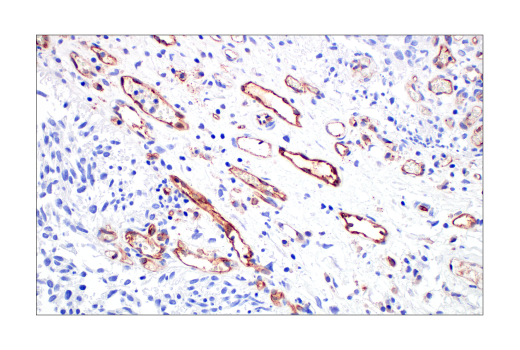 Immunohistochemistry Image 5: CD31 (PECAM-1) (89C2) Mouse mAb