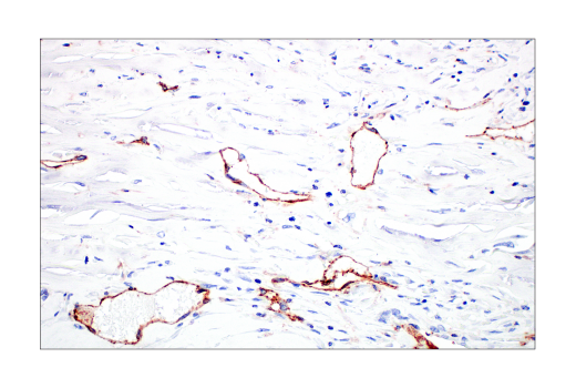 Immunohistochemistry Image 6: CD31 (PECAM-1) (89C2) Mouse mAb