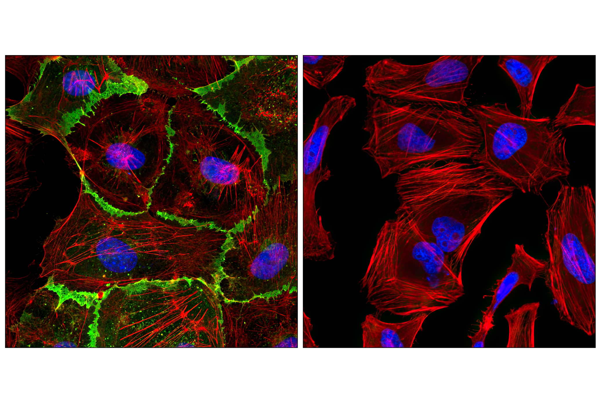 Immunofluorescence Image 1: CD31 (PECAM-1) (89C2) Mouse mAb