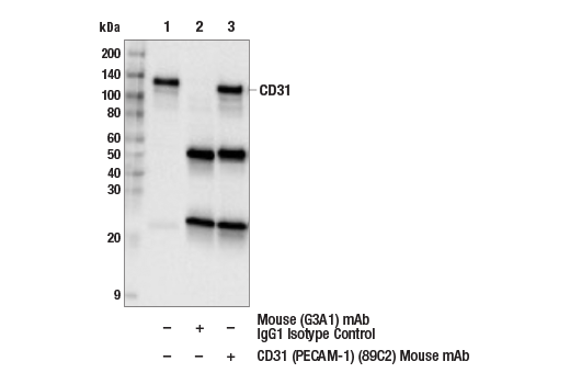Immunoprecipitation Image 1: CD31 (PECAM-1) (89C2) Mouse mAb